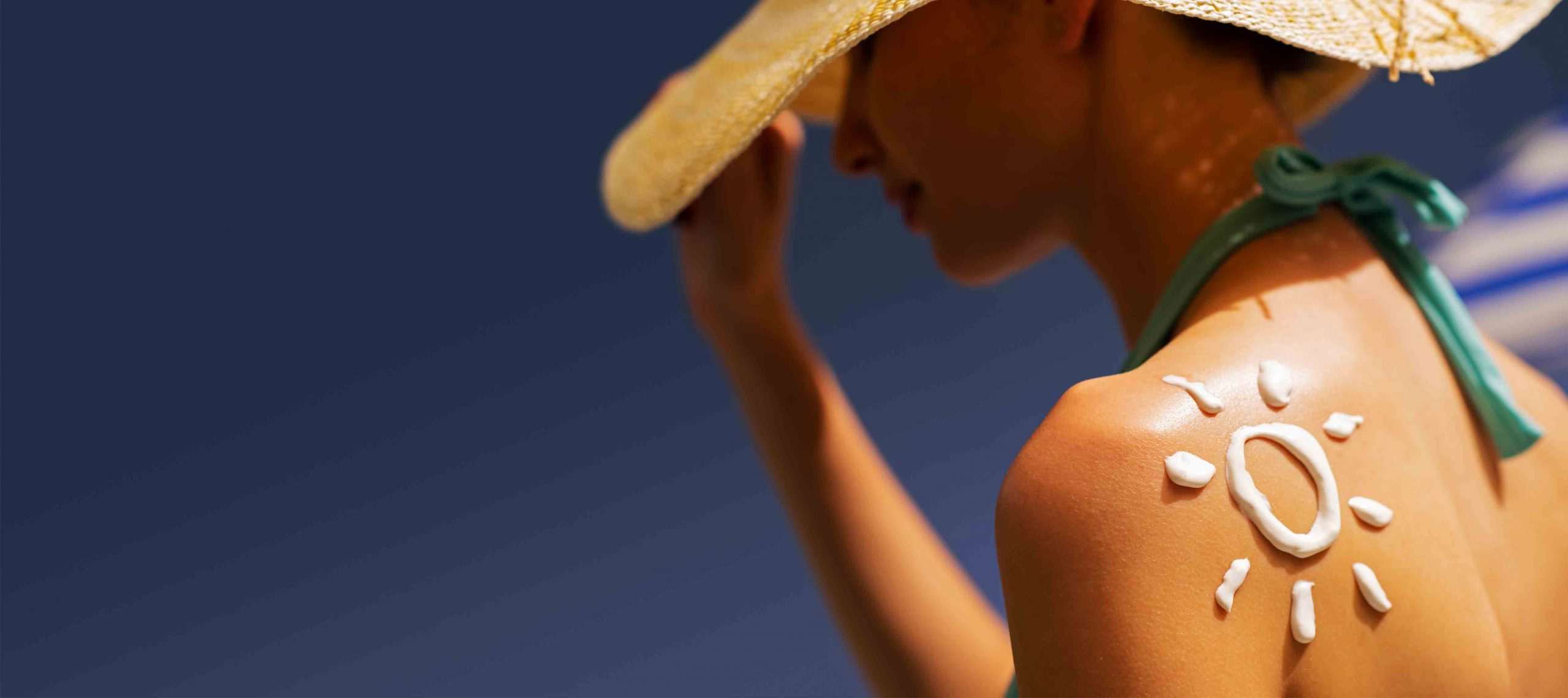 Avoid exposure to the sun